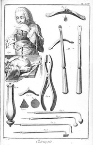 Instruments de chirurgie, XVIIIe
In Encyclopédie, Recueil de planches, Diderot et d'Alembert, XVIIIe. 